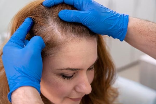 Femme recevant un traitement contre la perte de cheveux dans une clinique. Shampoing pour alopécie androgénétique