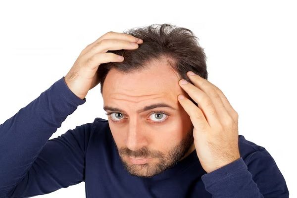 Prendre soin des cheveux gras