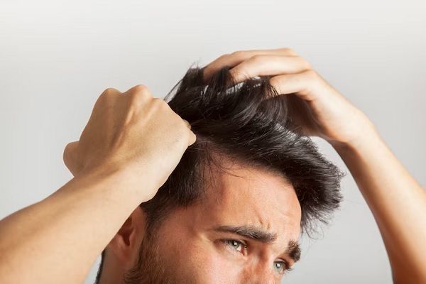 Prendre soin des cheveux gras