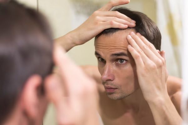 Prendre soin des cheveux gras
