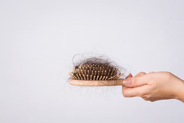 Main de femme tenant un peigne avec perte de cheveux sur fond blanc. 
