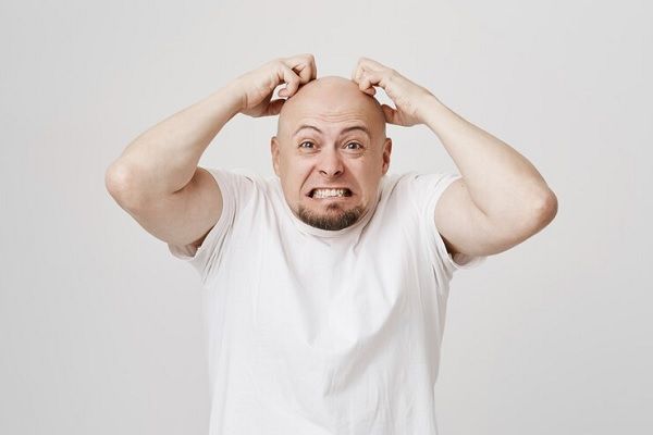 Un chauve en colère serre les dents et se gratte la tête. Le stress influence-t-il la chute des cheveux 