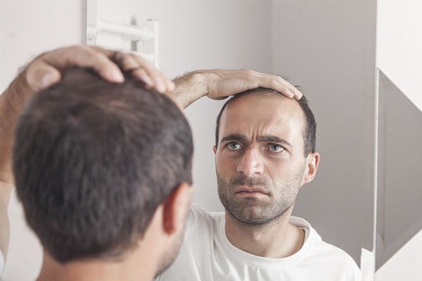 Comment diagnostiquer l’alopécie ? Il se regarde dans le miroir et constate son problème d'alopécie. 
