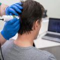 La thérapie capillaire au laser pour la perte des cheveux