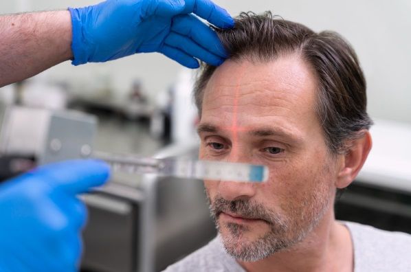 Homme recevant un traitement contre la perte de cheveux, Thérapie capillaire laser pour la perte des cheveux