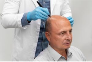 Homme subissant un processus d'extraction d'unités folliculaires 