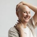La chimiothérapie est l'un des traitements anticancéreux les plus courants pour les patients. Ce produit chimique endommage les cellules à croissance rapide, telles que les cellules cancéreuses, et c'est pourquoi la chimiothérapie s'attaque à elles. Le reste de ces cellules se trouve dans les cheveux, c'est pourquoi le fait de les endommager entraîne la chute des cheveux.
