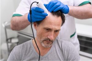 Homme recevant un traitement contre la perte de cheveux