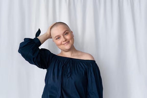 Jeune femme luttant contre le cancer du sein. perte de cheveux pendant un traitement anticancéreux
