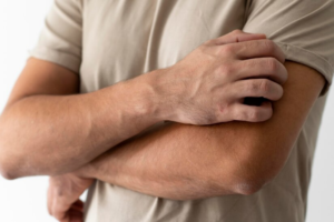 Test de réaction allergique cutanée sur le bras, Remèdes naturels contre la dermatite séborrhéique 