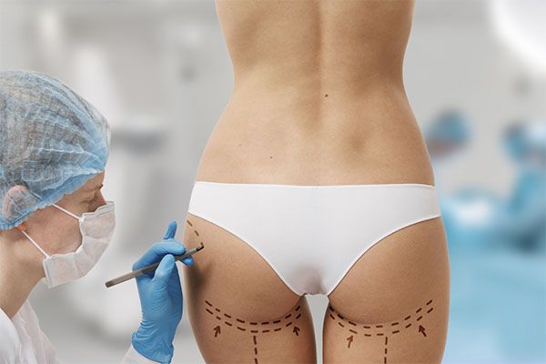 femme mince traitée dans une clinique de chirurgie esthétique en Turquie