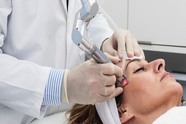 femme recevant un traitement au laser pour le contour des yeux