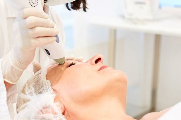 femme recevant un traitement au laser pour le contour des yeux