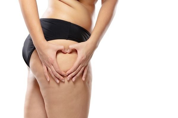 Femme en sous-vêtements noirs avec cellulite
