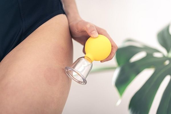 Femme en sous-vêtements noirs avec cellulite