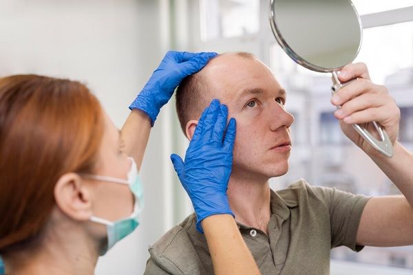 Homme adulte ayant des problèmes de calvitie. Types de greffes de cheveux 