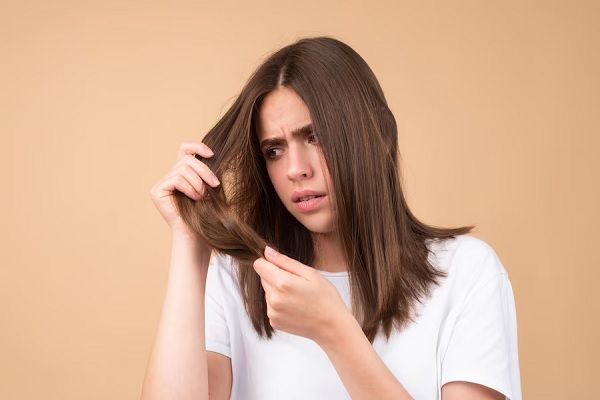 Femme avec problème de cheveux Femme semble surprise par ses cheveux perdus Tête chauve et concept de traitement capillaire. perte de cheveux chez les femmes