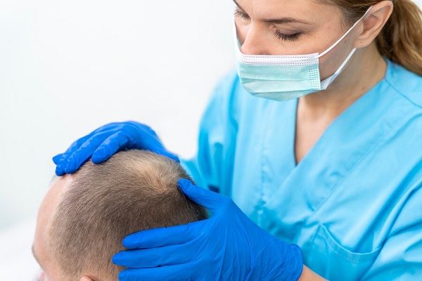 Homme mûr avec problème de calvitie.
Technique MicroFUE qu'est-ce que c'est, avantages et inconvénients 
