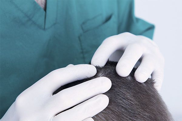 Comment choisir un chirurgien de greffe de cheveux